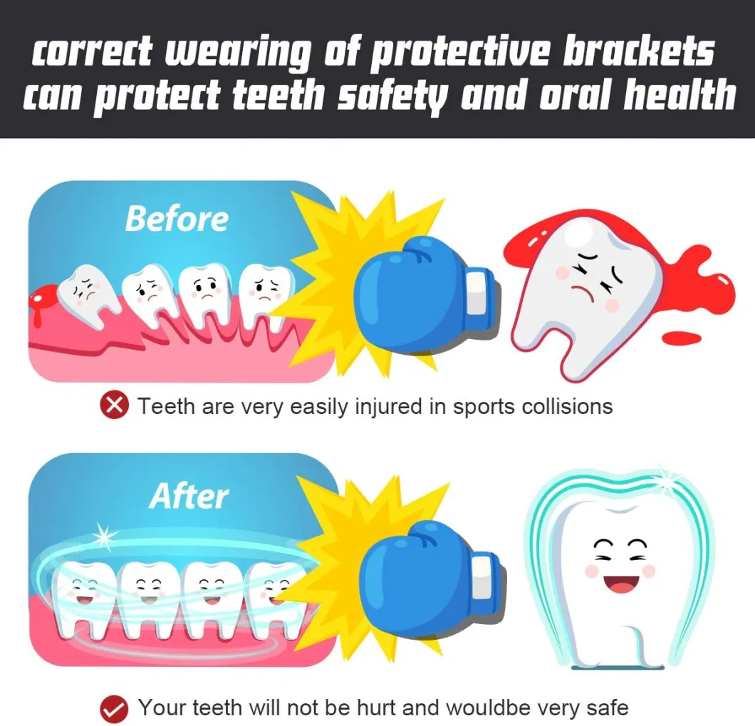 Sportl Mouth Guard for Football, Boxing, Youth & Adult